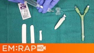 Epistaxis Management