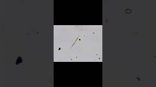 Microscopic Organisms in Pond Water