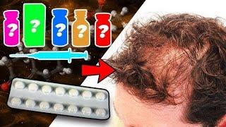 Can Medications Stop Hair Loss?#hairloss