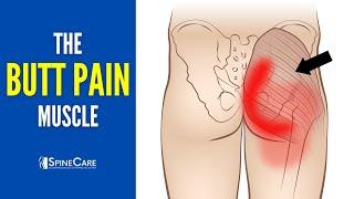 The Butt Pain Muscle (How to Release It for INSTANT RELIEF)