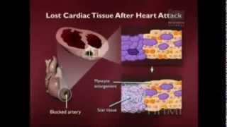 Fibroblast Growth Factor FGF - Stem Cell Therapy