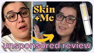 An honest and UNSPONSORED review of Skin+Me