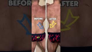 No more stretch marks ️