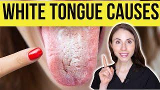 What Causes White Tongue?