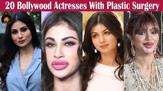 20 Bollywood Actresses With Plastic Surgery | Actresses Plastic Surgery Before and After #viral #4k