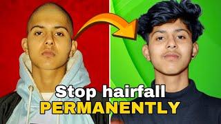 Loosing hairs = 50x worse life || How To Stop Hair fall inmen || How to fix male pattern baldness