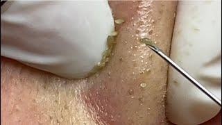 Priority preview content for registered members Spa Linh Mun #44