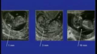 AIUM Guidelines for Obstetrical Ultrasound