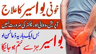 Bawaseer Ka Ilaj | Piles Treatment | Wazifa For Hamorrhoids | Qabz aur Bawaseer Ka Ilaj | Upedia