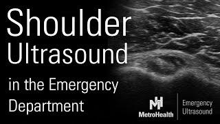 Shoulder Ultrasound in the Emergency Department
