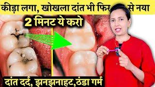 सिर्फ़ 2 मिनट ये करो कीड़ा लगा ,खोखला दांत भी फिर से नया | Teeth Cavity