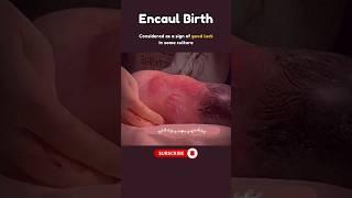 Amazing Baby in Amniotic Sac #pregnancy #fetus #subscribe