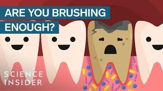 Here's What Happens If You Stopped Brushing Your Teeth