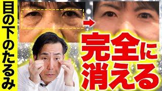 【老け顔の原因】目の下のぶよぶよを1分で完全に消す『眼輪筋ケア』【たるみ リンパケア】