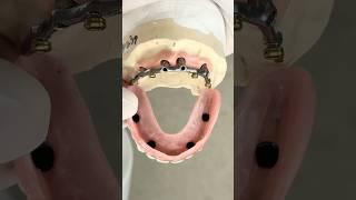 Locking onto a hybrid bar #lsk121shorts #dentist #teeth