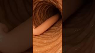 How The Gut look like Without Deworming | Realistic AI Art | Gut Health | Anatomy AI Arts USA | 27