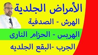 علاج الأمراض الجلدية - الهرش - الصدفية - الهربس - الحزام النارى - الجرب - البقع الملونه