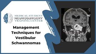 Management Techniques for Vestibular Schwannomas