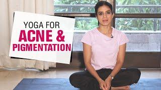 Facial Yoga to Treat Acne, Scars, and Pigmentation | Yoga for Skin Problems | Fit Tak