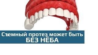 Съемные зубные протезы: съемный зубной протез sandwich (сендвич)