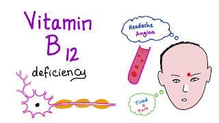 Vitamin B12 (Cobalamin) Deficiency - Causes, Symptoms, Diagnosis & Management - Hematology Series