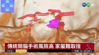 應用虛擬實境 腦部手術更精準