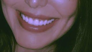 You have perfectly aligned & straight teeth | Forced subliminal