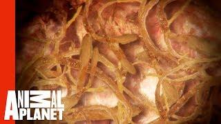 A Deadly Roundworm Parasite Is Causing This Woman's Painful Rashes