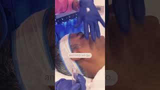 Experience the Ultimate Glow: Hydrafacial MD at Centre for Aesthetics, Gurgaon 