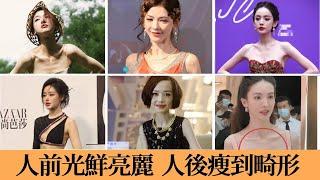 七年不吃主食！排骨胸、筷子腿、膝蓋凸骨、瘦到脫相！畸形審美毀掉多少明星？#古力娜扎#金晨#吴谨言#张天爱#张予曦#杨颖#