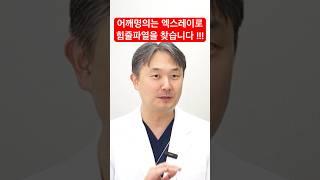 어깨 회전근개파열 진단시 엑스레이 활용 [날아라정형외과 어깨수술중점 이원준]