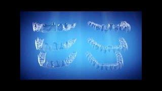 Straight Talk About Crooked Teeth | Invisalign