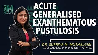 Chapter 61-A | Acute Generalised Exanthematous Pustulosis (AGEP) | Dermatology | OneMedicine