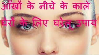 Desi style Homemade nuska to remove ur eyes dark circle