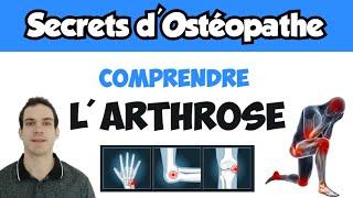 Arthrose : Causes, Symptômes et Solutions pour soulager la douleur