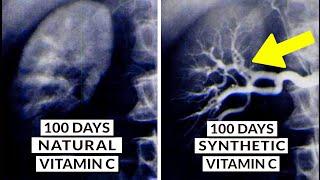 We Finally Know What Type Of Vitamin C Is Best