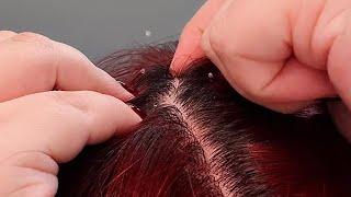 Relaxing ASMR: Scalp Spa Session - Gentle Dandruff Removal (No Talking)