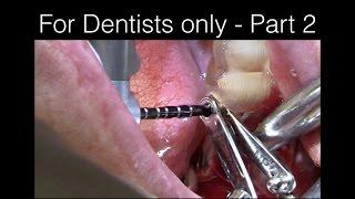 ***For Dentists only part 2 - Surgery with Scott MacLean