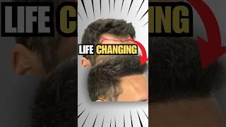 2.335 Grafts Changed His Life