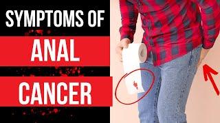 Doctor explains SYMPTOMS OF ANAL CANCER - plus risk factors, diagnosis and treatment