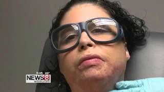 Dr. Ibrahimi Uses the Latest Laser Technology to Help a Domestic Violence Survivor