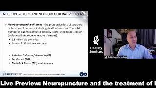 Neuropuncture and the Treatment of Neurodegenerative Diseases, by Michael Corradino