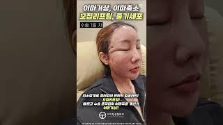 #아이팅성형외과 에서 수술 받으려고 태국에서 왔어요!!(꼬집리프팅+이마축소+이마거상+줄기세포)
