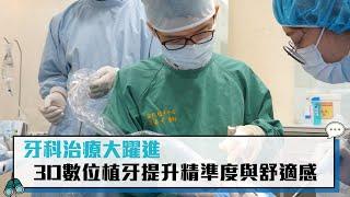 【CNEWS】牙科治療大躍進 3D數位植牙提升精準度與舒適感