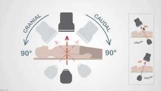 Mastering Coronary Angiography: Image Intensifier & C-arm Fundamentals