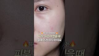 피부 난리 났을 때 제발..꼭 이렇게 하세요 (올영 꿀템)