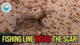 Buried Deep in Flesh: Fishing Line Almost Killed Him