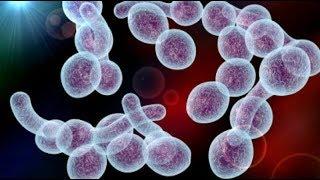 Грибки и паразиты Candida, кандида. Как избавиться от паразитов. Советы врача Елена Бахтина.