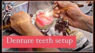 SETTING DENTURE TEETH #WAXBAE #DENTURE #TEETH