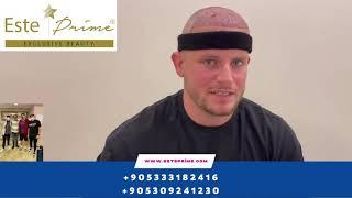 HAİR TRANSPLANT TURKEY -İSTANBUL #hairtransplantationturkey